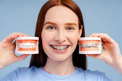 does maxicare cover dental braces|Understanding Maxicare Insurance Coverage For .